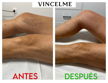 Vincelme® Cápsulas Remolacha Natural